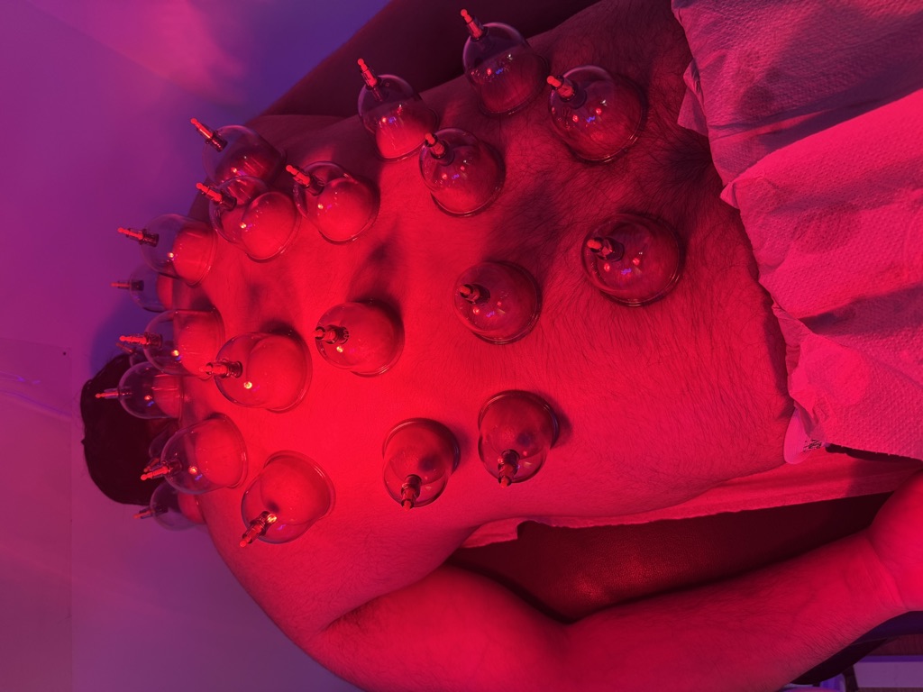 Hijama Driver · foto 1