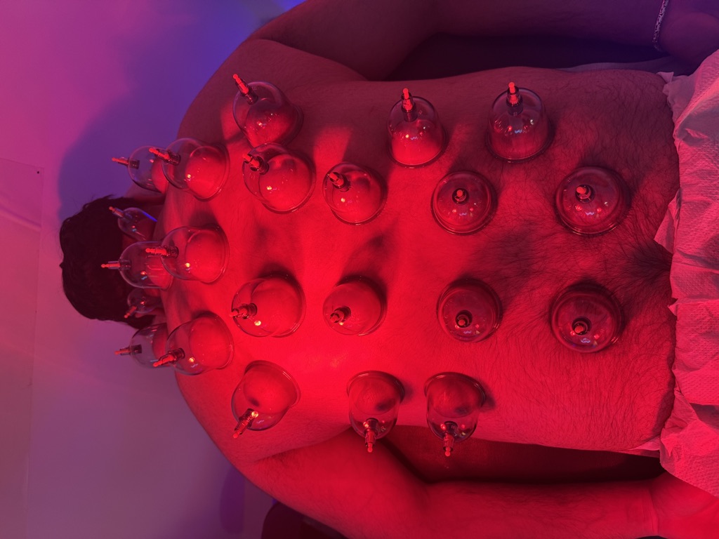 Hijama Driver · foto 2