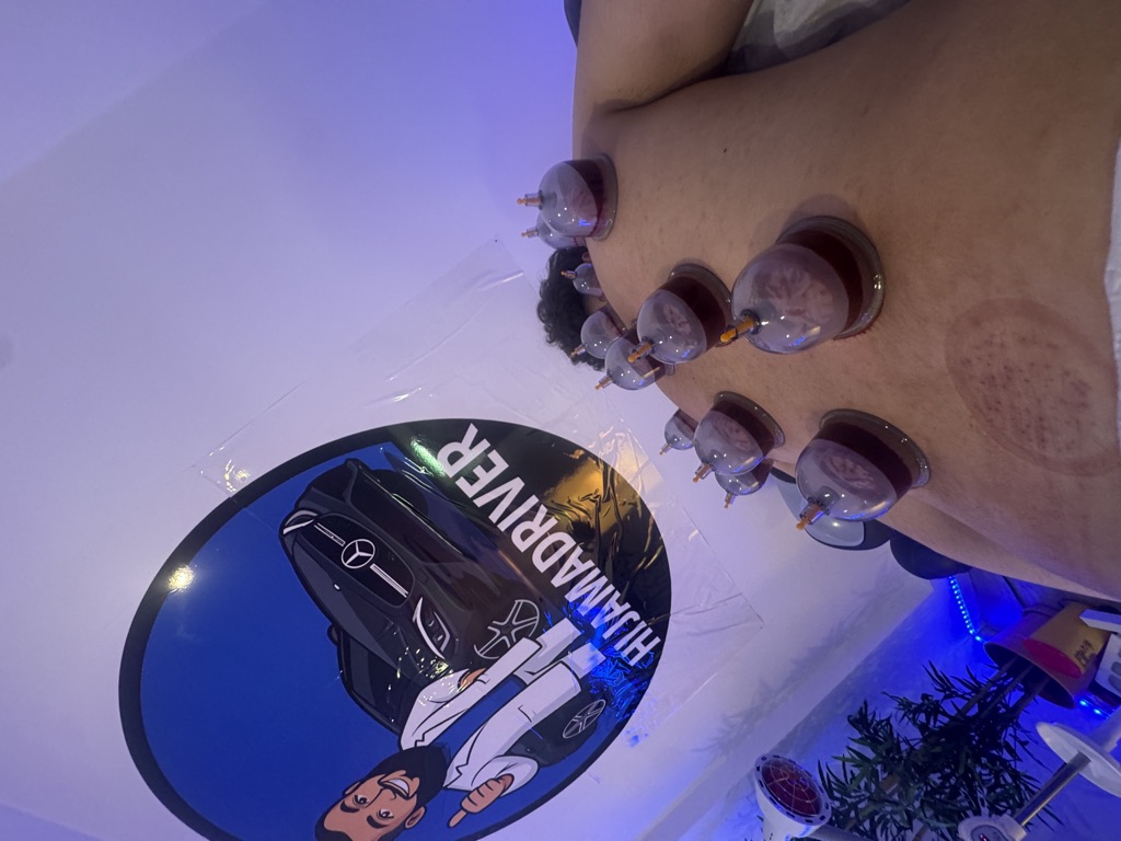 Hijama Driver · foto 3