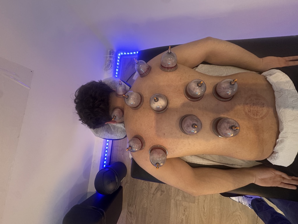 Hijama Driver · foto 4